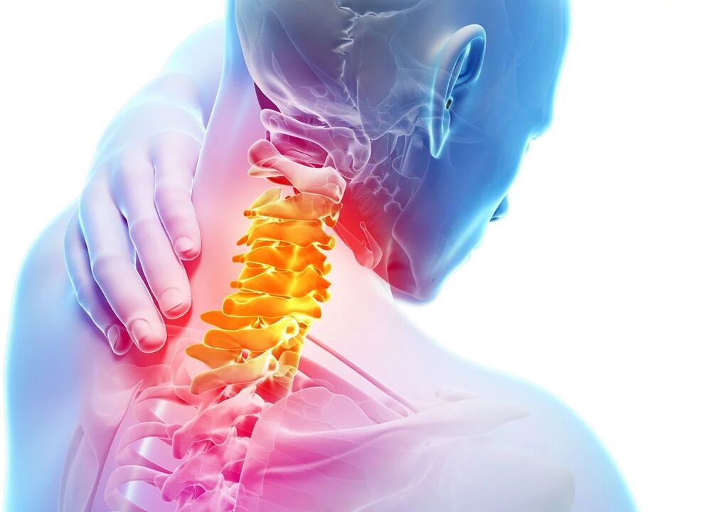 Osteocondrosi cervicale