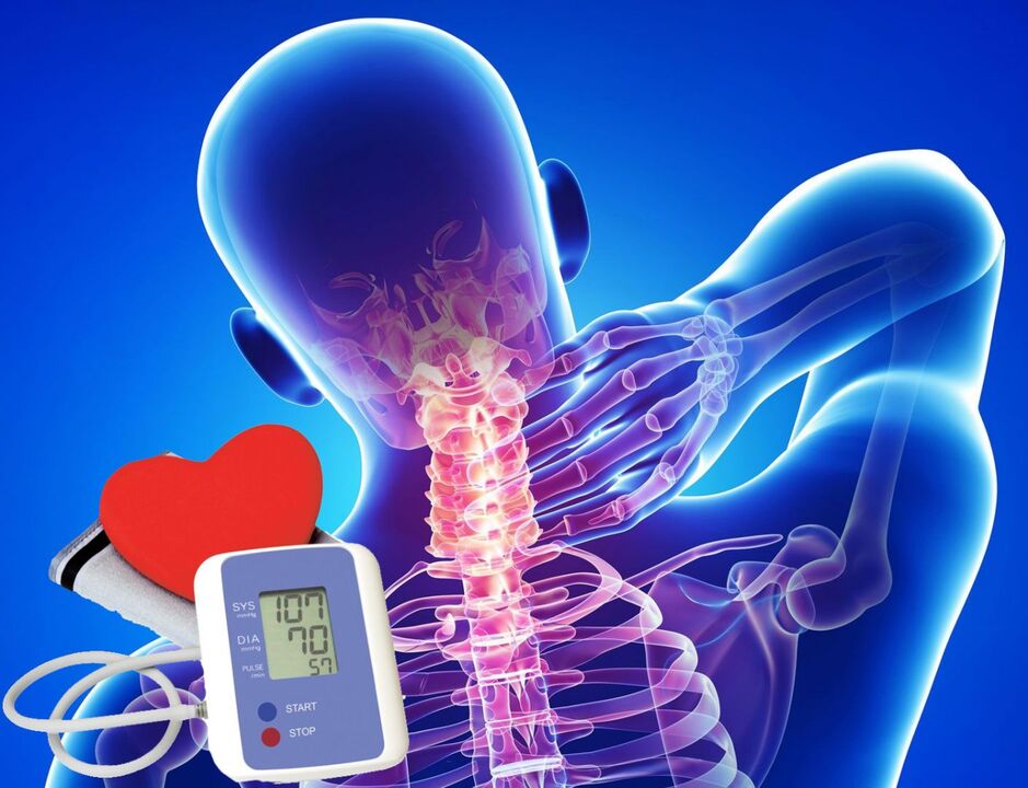 Visitato la pressione sanguigna per l'osteocondosi cervicale