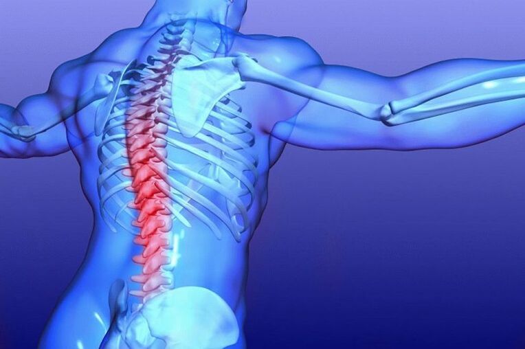 Danni alle radici del midollo spinale