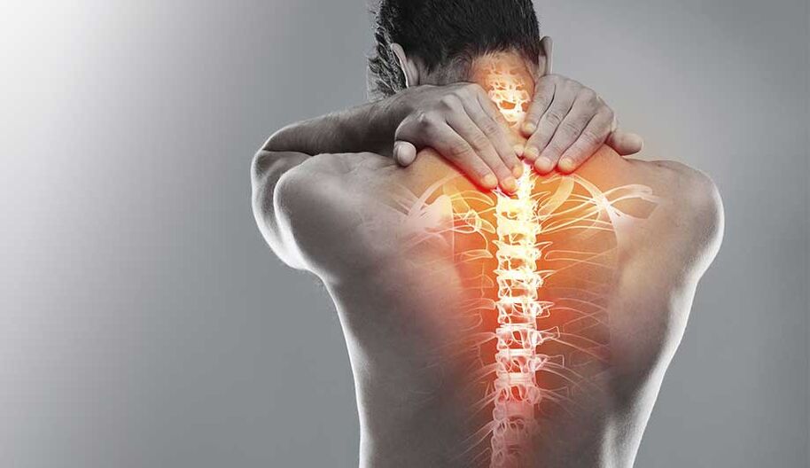 Dolore alla colonna vertebrale dovuto all'osteocondrosi