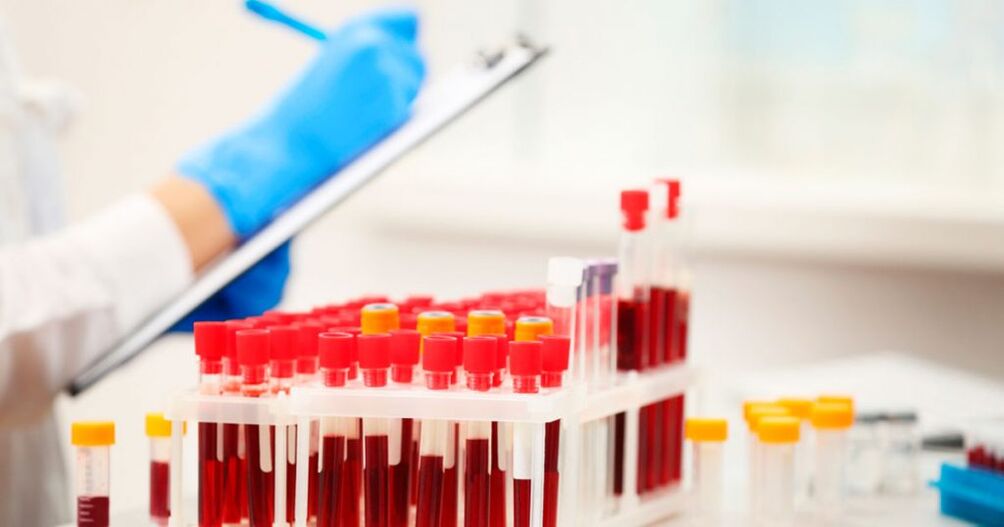 Esecuzione di un esame del sangue per rilevare l'infiammazione